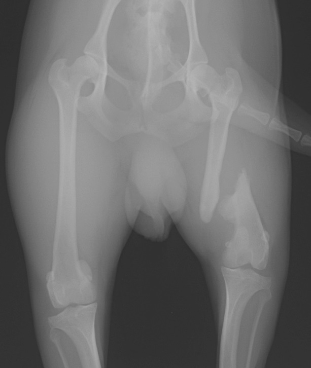 大腿骨骨折整復術