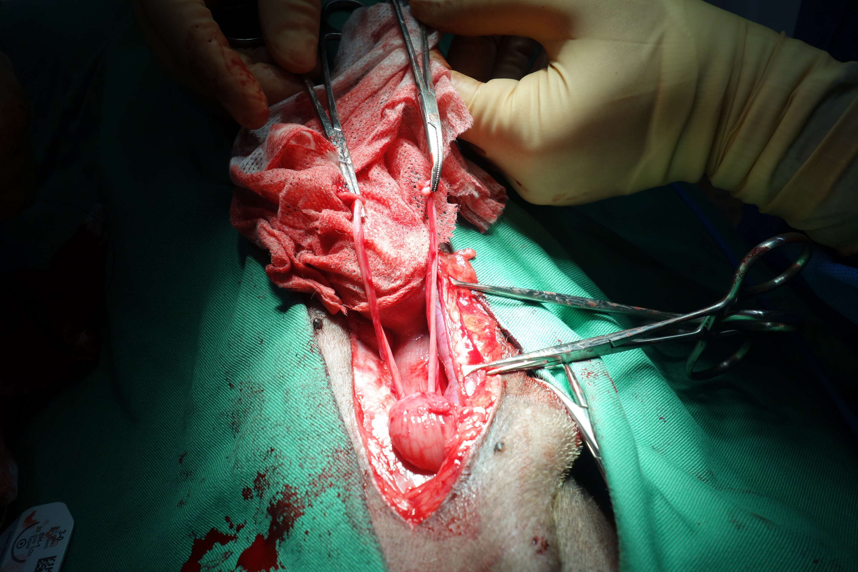 内閉鎖筋転移と直腸固定による会陰ヘルニアの整復